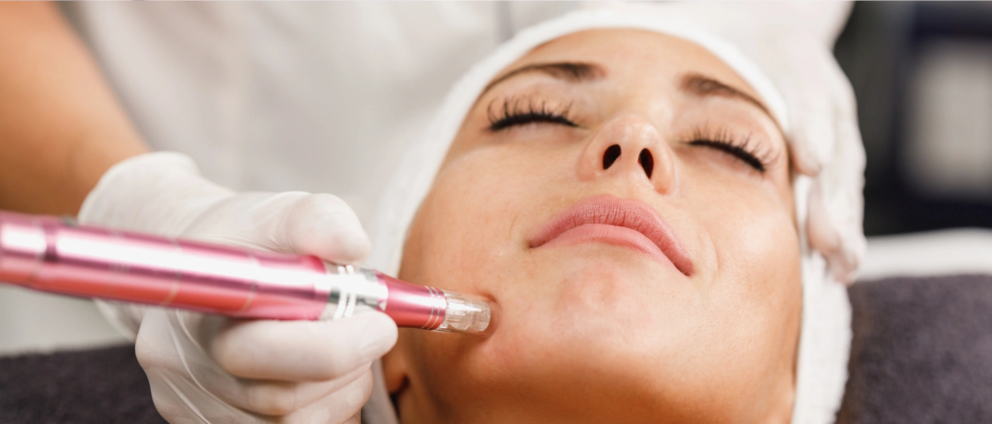 Kosmetikerin behandelt das Gesicht einer Kundin mit einem Microneedling-Gerät